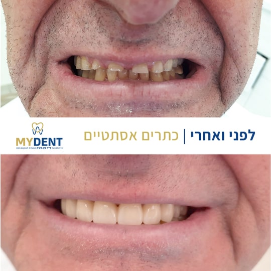 before-after-1-min